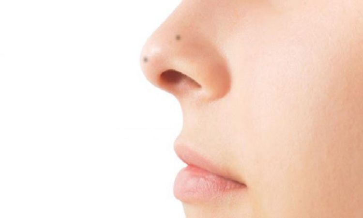 1561886494 nose