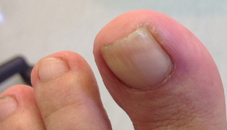 1563973469 pain in nails