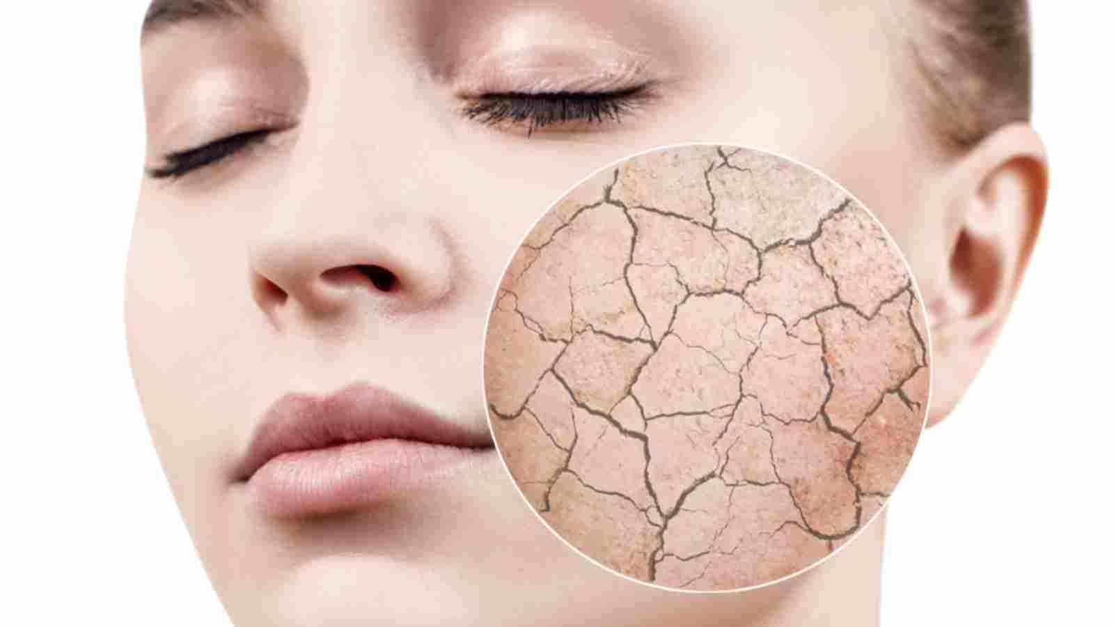 1569504152 dry skin البشرة الجافة