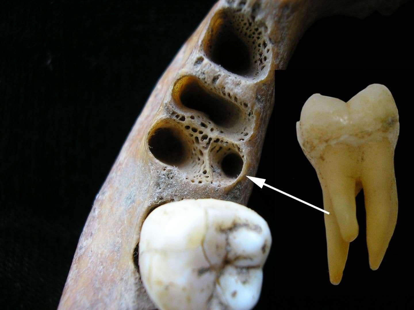 1570186255 denisovan woman s finger bone and teeth