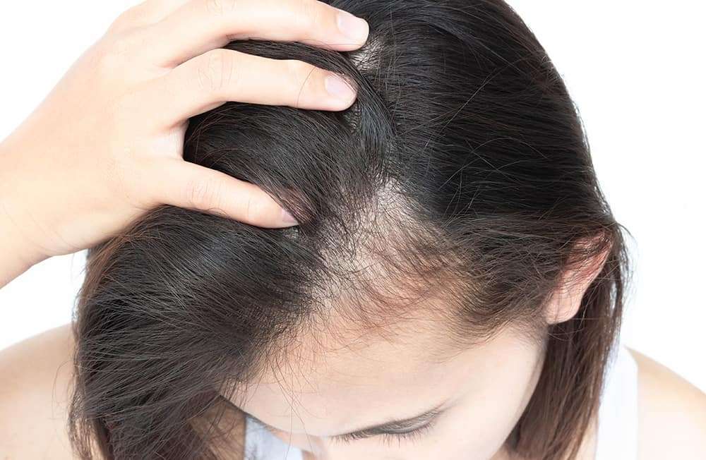 1586600330 hair fall woman