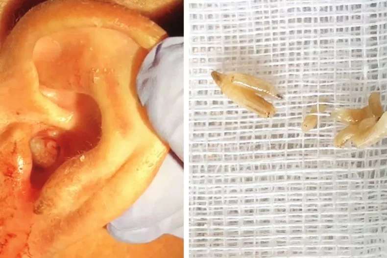 1686564598 worms ear