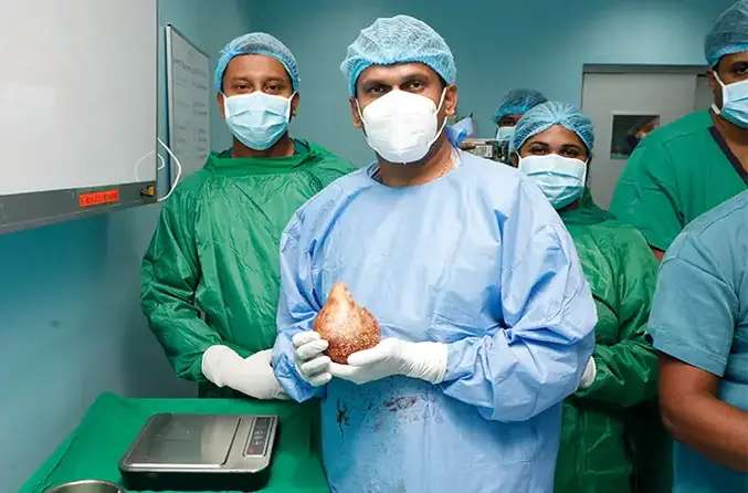 1686905909 doctor holding largest kidney stone tcm25 753046