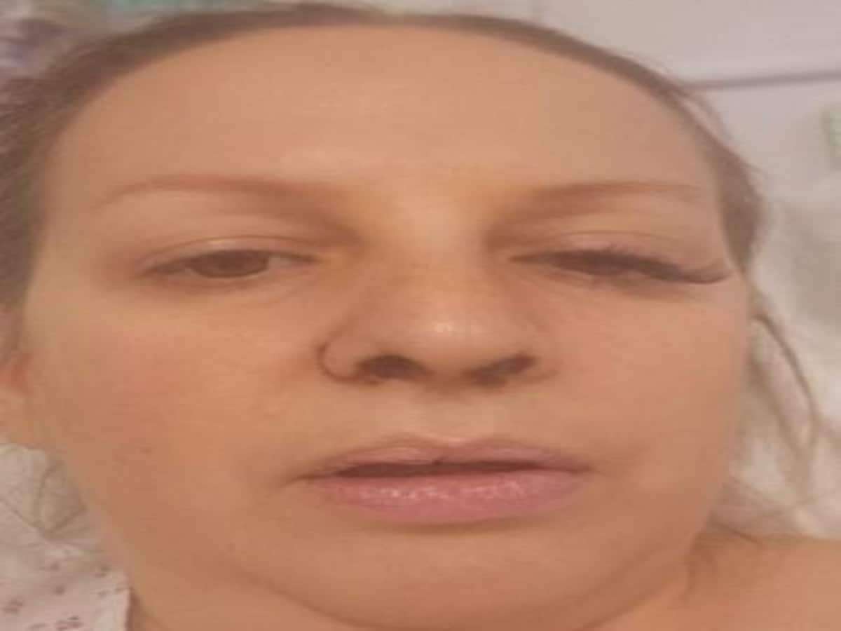 1688454710 eye infection turns brain tumour 1