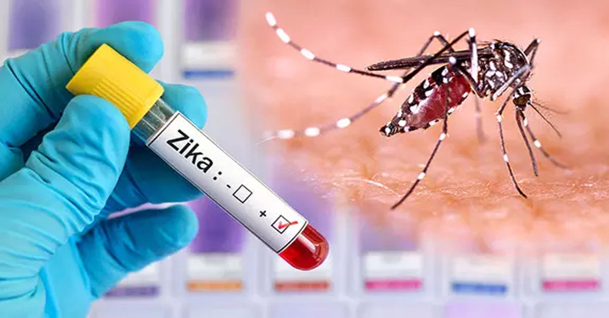 Zika virus advisory